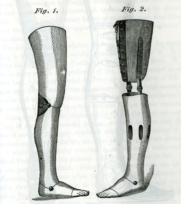 A prosthetic leg