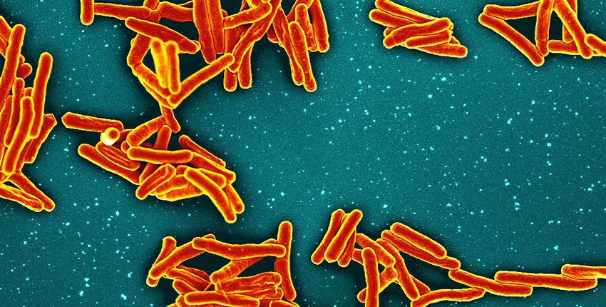 Orange and yellow particles on a green background representing the bacterium that causes TB