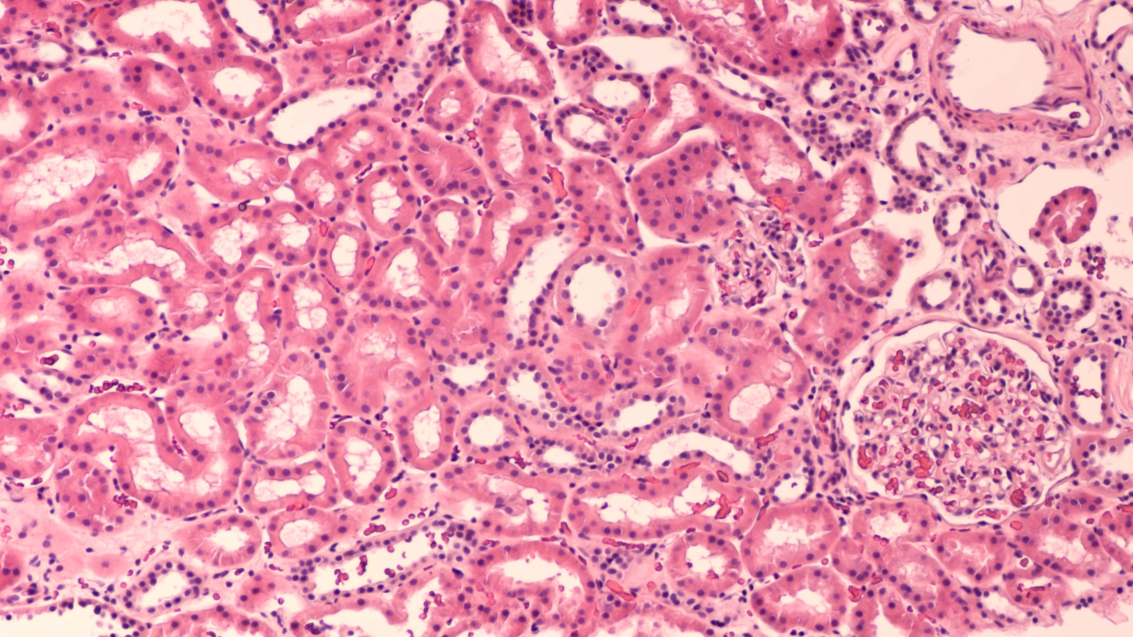 human cells seen under a microscope.