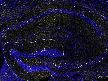 Blue and black image of T-cells